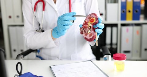 Doctor urologist and nephrologist holds kidney model