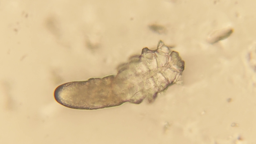 Footage of Demodex or face mites
 under the microscope  Royalty-Free Stock Footage #1089913135