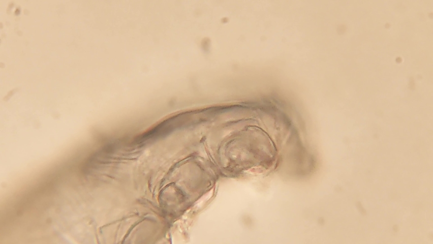 Footage of Demodex or face mites
 under the microscope  Royalty-Free Stock Footage #1089913137