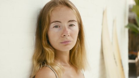 Fashion portrait of cute young woman with vitiligo pigmentation posing over white wall with surfboards, looking to camera