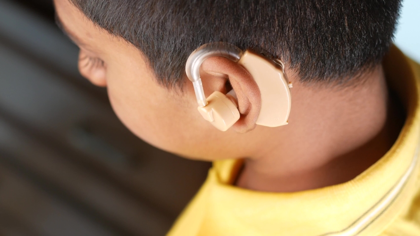 Hearing aid concept, teenage boy with hearing problems. | Shutterstock HD Video #1089993111