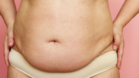 274 Naked obese woman Stock Video Footage - 4K and HD Video Clips