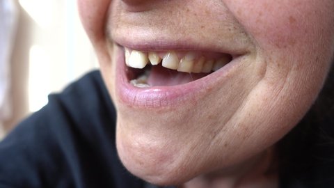 4K Side view on smiling mouth with one tooth crown and one stub
