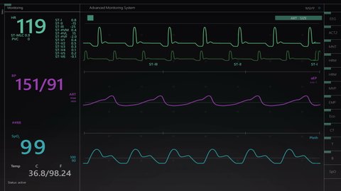 Vital Signs Monitor with Heart Rate and Other Medical Parameters on an Animated Mock-up. Patient's Vitals and ECG Graph for Intensive Care Unit Template for Computer Displays and Laptop Screens.