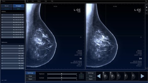 Mammogram Breast Scan Mock-up with Multiple Windows and Data. Medical Research Environment Software with X-Ray Scan Results for Computer Displays and Laptop Screens.