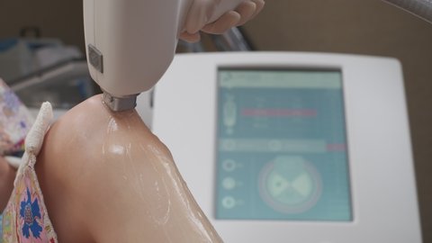 Leg laser epilation procedure while laser hair removal machine is used by specialist