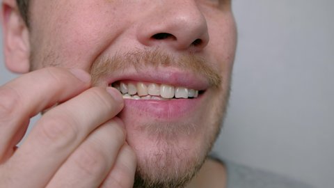 Using Toothpick. Etiquette and Good Manners. Close Up. A young man takes out the remnants of food stuck in his teeth with a toothpick close-up 