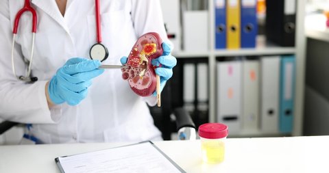 Nephrologist holding model of human kidney in clinic