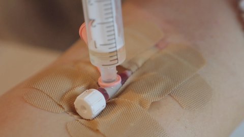 Close-up on the hand of a syringe with a catheter, injection of medication, dropper