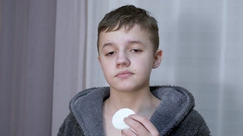 Frustrated Teenager Cleans, Wipes his Face from Acne using a Cotton Pad. Dissatisfied boy in a bathrobe with skin problem, acne during puberty. Problematic skin, acne, rashes, redness, blackheads.
