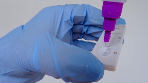 closeup female hands holding PCR test cassette, dripping liquid, assistant makes express test in medical scientific laboratory, stirs sample of genetic sample, concept of covid-19 infection