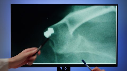 Doctors veterinarian examining cat or dog skeleton roentgen on computer monitor. Man and woman vet analyzing animal bones x-ray close-up. 