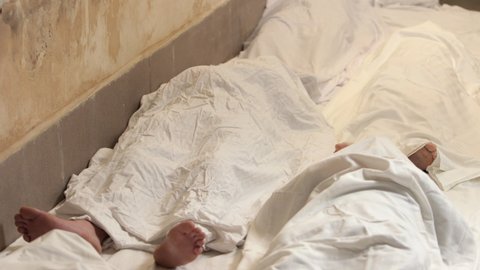 People with congenital disease are at higher risk of contracting covid-19 disease. Closeup of corpse. Two feet of dead body. Covered with white sheet.