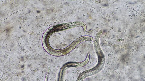 Nematodes in compost being looked at in soil under the microscope 