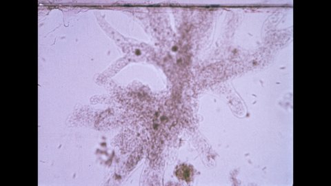1940s: Cells under light microscope, large, dark masses. Tiny specks swimming.