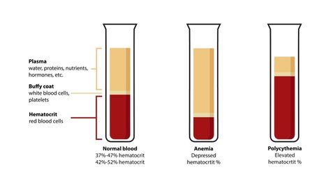 Composition of blood: plasma, buffy coat, hematocrit. Test tubes with correlation between red blood cells (erythrocytes), white blood cells (leukocytes), proteins, hormones. Anemia, polycythemia