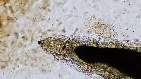 nematode in compost, in soil under the microscope	
