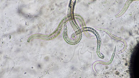 nematode in compost, in soil under the microscope	
