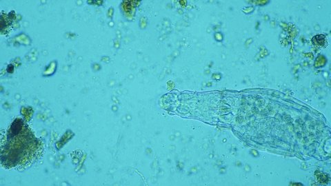 rotifer in soil, under the microscope.