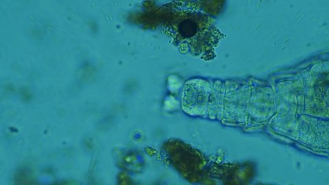 rotifer in soil, under the microscope.