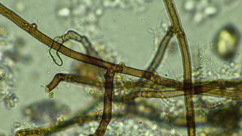 fungi and fungal hyphae under the microscope in the soil.