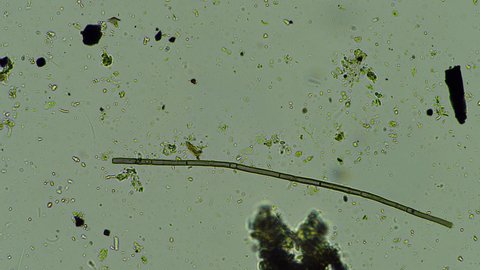 fungi and fungal hyphae under the microscope in the soil.