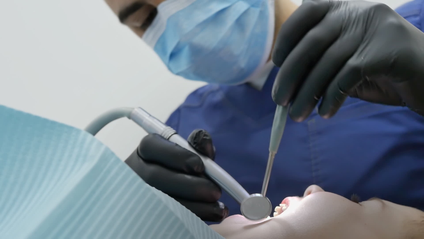 close-up A male pediatric dentist grinds a new filling in the tooth of a little girl with her mouth open wide, lying on a dental chair. smoothing the surface of the filling. microcontouring Royalty-Free Stock Footage #1090509083