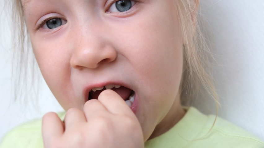 Portrait of a girl pulling out her baby tooth. Change of teeth. Loss of a baby tooth. The child's front tooth is loose.  | Shutterstock HD Video #1090533097