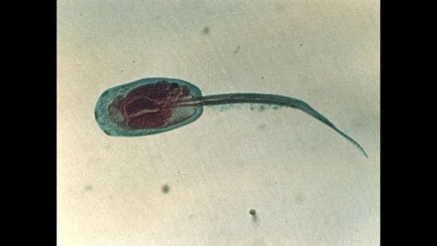 1960s: Lines appear over parts of photograph of amphioxus embryo. Worm appears in egg at bottom of aquarium. Man moves model from table revealing dead amphioxus.