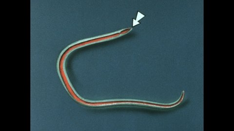 1970s: Diagram of small thin roundworm with arrows pointing to various parts. Diagram of cross section of roundworm. Microscopic worm wriggles about. Dead worm on display.