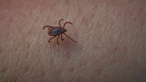 A dangerous parasite Hard tick or Scale tick (Ixodidae) crawls on human skin.