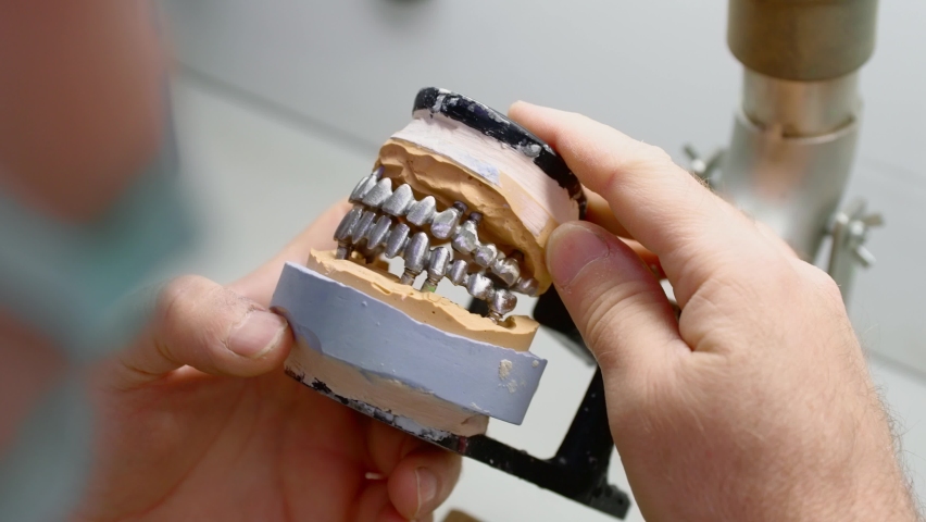 installation of dental multi-units after implantation for prosthetics ...