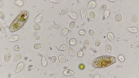 Coleps sp and another protist moving video. 400x magnification + 4x camera zoom