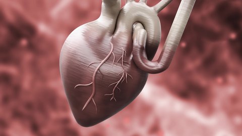 65 Acute Myocardial Infarction Stock Video Footage - 4K and HD Video Clips  | Shutterstock