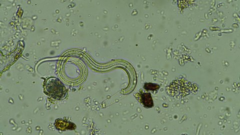 nematodes under the microscope in soil and compost