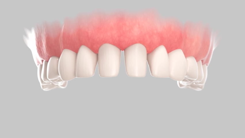 3d animation of placement dental veneers over central incisors Royalty-Free Stock Footage #1090916203