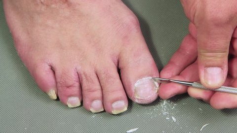 A hand with a metal scraper removes the cuticle of a male toe. The concept of male pedicure and foot care. Isolated video, copy space, close-up. UHD 4K.