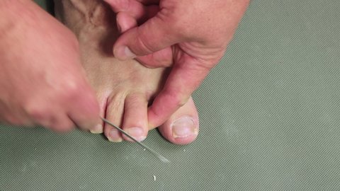 A hand processes the nail of the middle toe of a male foot with a metal file. The concept of male pedicure and foot care. Isolated video, copy space, close-up. UHD 4K.