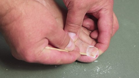 A hand with a stick cleans the cuticle of a male toe nail. The concept of male pedicure and foot care. Isolated video, copy space, close-up. UHD 4K.