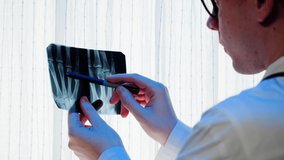 Doctor looking at hand fingers x-ray close-up. Magnetic Resonance Image of human arm. Man nurse examining xray of palm bones. Healthcare and medicine concept. - Powered by Shutterstock - Get 15% off with code: PIKWIZARD15