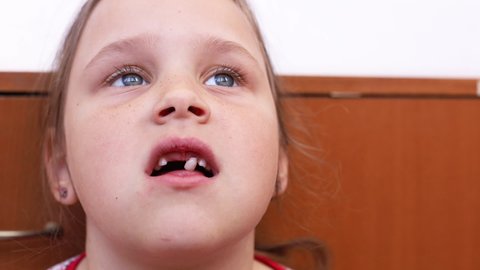 Little girl with blue eyes looking up, afraid of pain, baby milk teeth problem. Licking and touching by tongue sagging front tooth. Help removing primary changing teeth. Thick enamel, hygiene of mouth