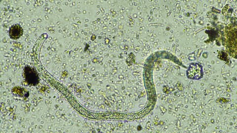 soil microbe organisms in a soil and compost sample, nematodes under the microscope in regenerative agriculture. in Australia.