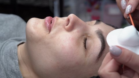A young woman undergoes an eyelash extension procedure and removes mascara with a cotton swab and stick in a beauty salon. Eyelid preparation.