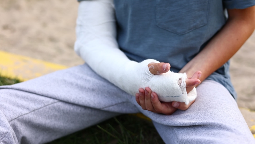 a child's arm is broken. little boy with a fractured limb outdoors. fracture injury in the summer holiday. kid is moving fingers in plaster cast on the arm Royalty-Free Stock Footage #1091383755