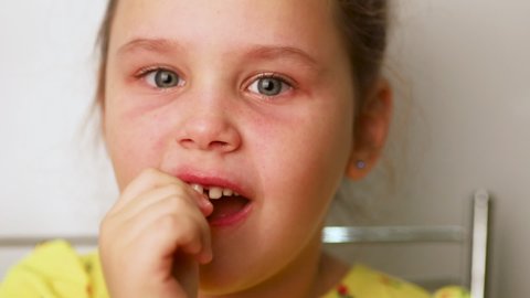 Little girl with tearful eyes shaking loose tooth with finger closeup, white blurred background. Face of anxious child, milk tooth extraction. Concept of healthy teeth and beautiful smile.