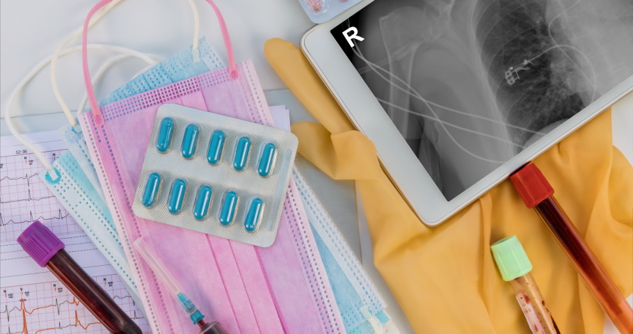 46 X ray pacemaker Stock Video Footage - 4K and HD Video Clips ...