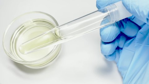 Urine sample in a test tube. Gloved doctor's hand holds a test tube with light yellow colour urine. Very good urine sample of a healthy person. Medical container for biomaterials. Medical analysis.