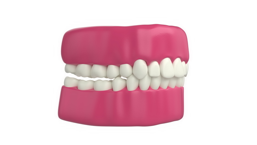 3d rendering of teeth with invisible aligners orthodontics on white background | Shutterstock HD Video #1091678719