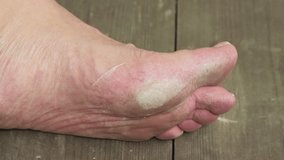 A man's hand cleans the foot with a grater. Keratinization and thickening of the epidermis in the plantar surface of the feet. Foot care concept. Isolated video, copy space, close-up. UHD 4K.