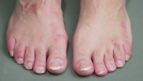 Men's legs scratch each other. Keratinization and thickening of the epidermis in the plantar surface of the feet. Foot care concept. Isolated video, close-up. UHD 4K.